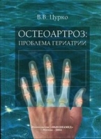 Остеоартроз: проблема гериатрии артикул 5770a.